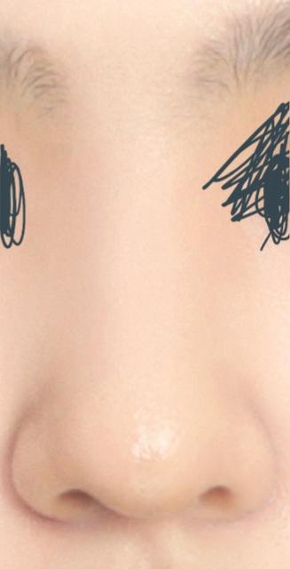 1이 정면 2가 측면인데 정면사진 코가 ㄹㅇ 에바임... 원래 코가 별로 안 예뻐서 ㅠㅠㅠㅠㅜㅠ 그거 감안하고 봐도 심각하게 콧대가 없어져...