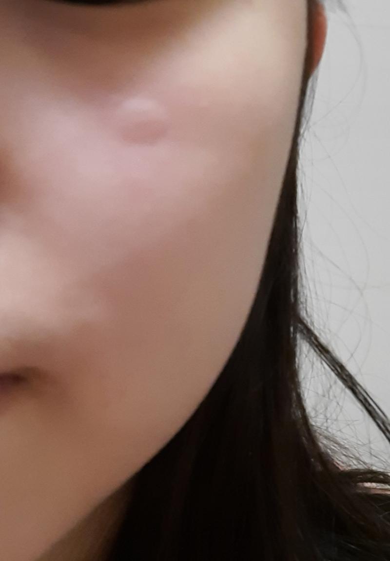 이건데.. 그냥 컨디션이 안 좋아서 그런거겠지..?