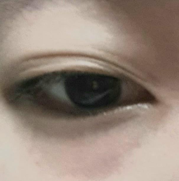 알바한지 3주만에 다크서클이 심하게 내려왓다