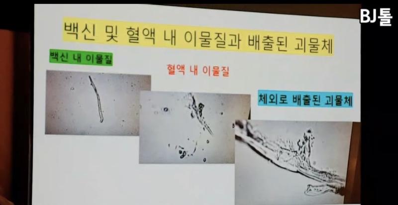 접종자 혈액 현미경 사진. 유트브에 검색하면 볼 수 있음.