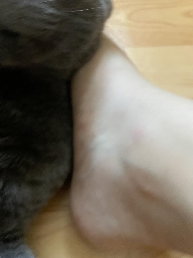 봉숭아 뼈 위에 봉숭아 뼈가 하나 더 생긴기분ㅎ 별로 안아파 보이는데 걸을때마다 욱신거령ㅎ 젠장