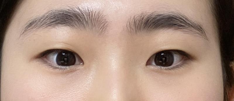 너무 가까이서 찍은 관계로 피부 안 좋음.. 비위ㅣ상할수도잇음주의..