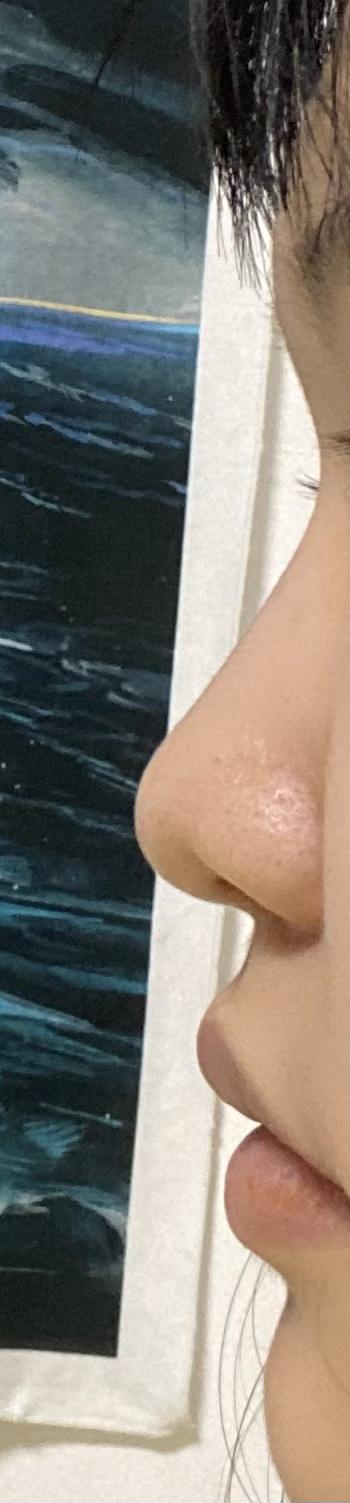 코 높이 사진이야