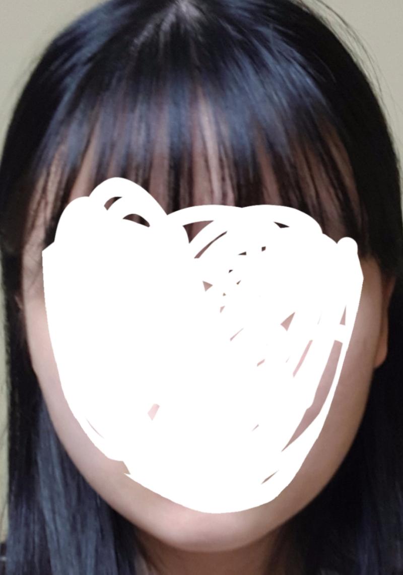 앞머리 기름 심해서 좀 떡졌어 미안ㅠㅠ 평소에 첫번째로 하고 다니는데 가끔 머리 뒤로 넘기면 두번째처럼 똥그래ㅠㅠ ㅣ약간 네모같기도..