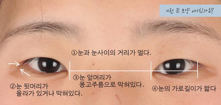 비교적으로 동서앙인 눈으로 비교하면 편해 물론 동양인 눈을 서양인 눈만큼 틔게 만드는 건 어려우니 감안은 해주고 눈이 트이면 점막도 많이 보임 