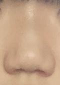코만 따로 보면 얼굴 전체 본 거보다 낫긴 한데 얼굴 전제는 진짜 코 때문에 우웩