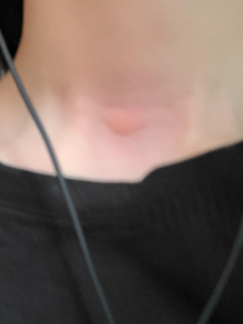 좀 가려운데 이거 단순한 한랭 알레르기겠지..? 근데 내가 평소에 미술입시를 해서 좀 자주 피곤해 ㅠㅠ 그 영향인가 싶기도 하고..