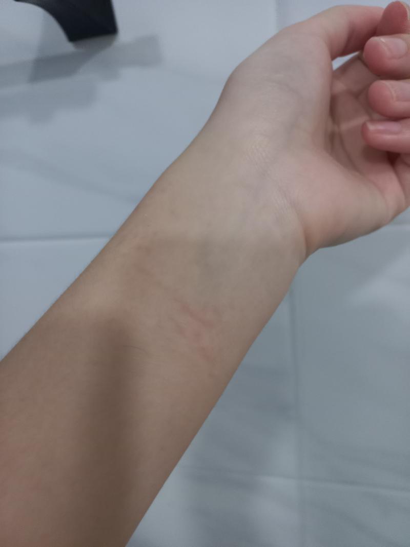 헹 목욕하던 중 깨달았어 근데 보니까 약간 두드러기나 발진같아보이네