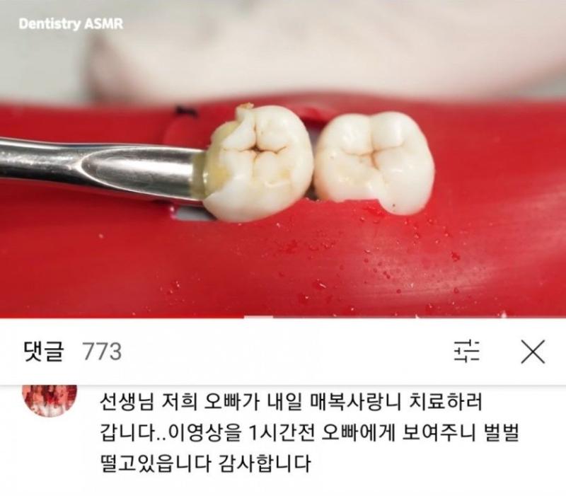 1 사랑니발치 영상의 활용법 2 이걸 번역기가 3 일꾼밥