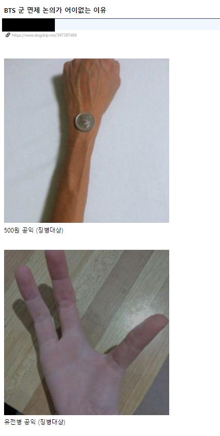 (사진이 다소 징그러울 수 있으니 후방주의) 인기있는 연예인들은 참 좋겠다 돈도 명예도 넘치는데 군면제까지 되서ㅋㅋ 일상생활에 지장갈 정도로 몸