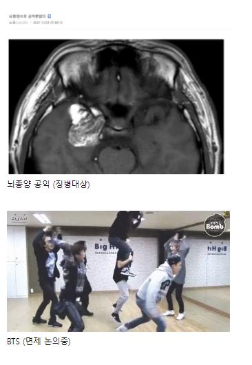 (사진이 다소 징그러울 수 있으니 후방주의) 인기있는 연예인들은 참 좋겠다 돈도 명예도 넘치는데 군면제까지 되서ㅋㅋ 일상생활에 지장갈 정도로 몸