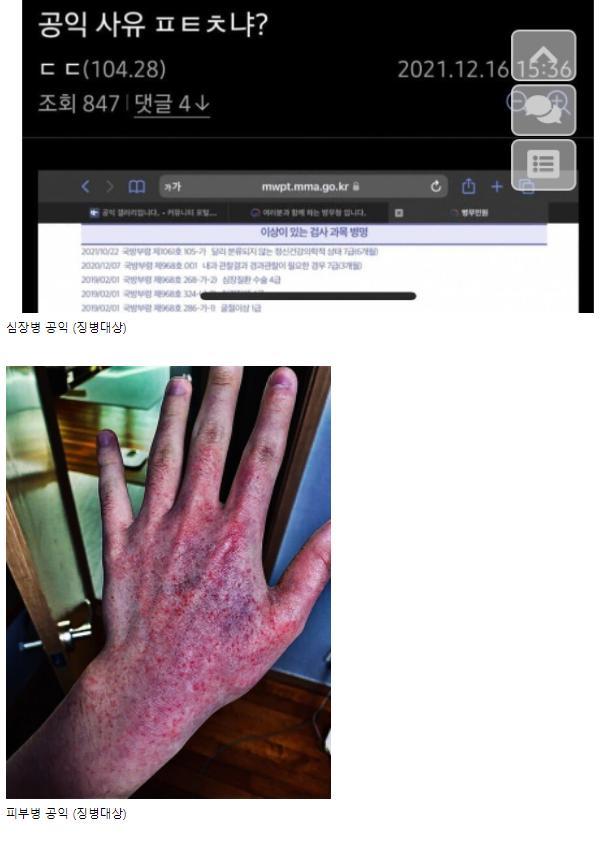 (사진 징그러우니 열람 주의) 슬라임(액체괴물) 알레르기(?) 나만있어? 나 초딩 잼민이때 있었던 일인데 내가 워낙 몸도 약하고 아토피도 심해가