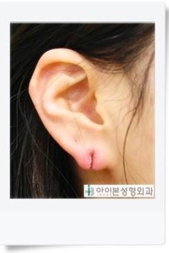 아니 교칙에 어긋나는거 아니면 신고해 제발 레스주들이랑 싸우지말고; 친구입장에서는 선생님과 대화, 학생부선생님과 대화, 교장쌤과 대화, 학생회를