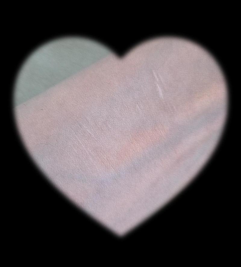 나 그렇게 세게한 적도 없고 자해 오래 한 것도 아니고 이제 4년 지났는데 안 없어졌어 사진은 흉터 사진