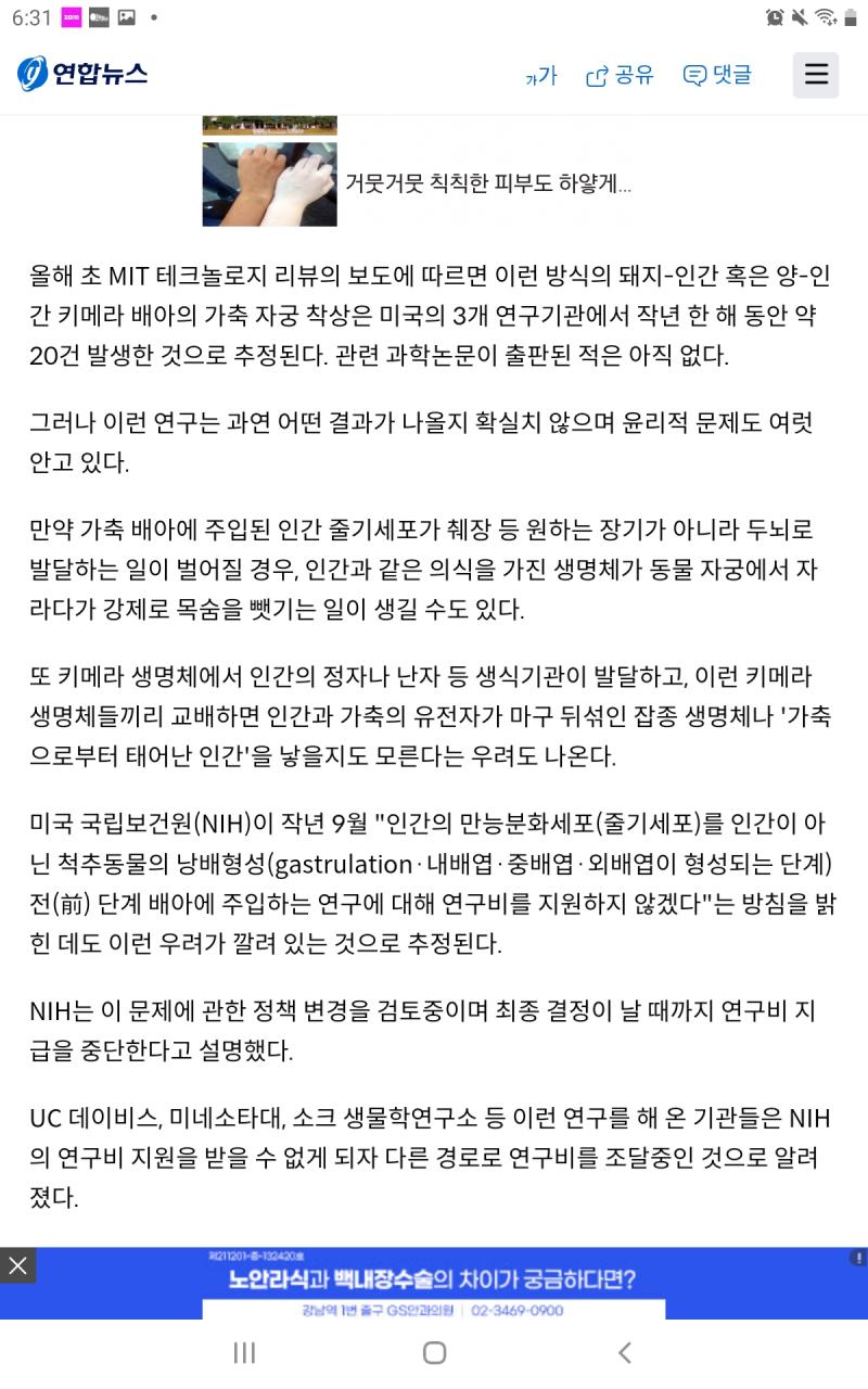 스레주 이 기사는 찾아봤어?
