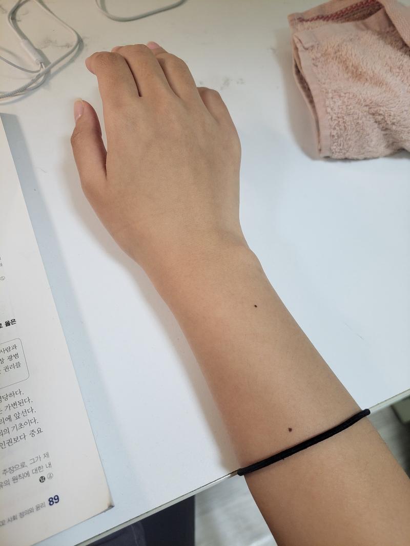 위 다친곳 아래 멀쩡한 곳