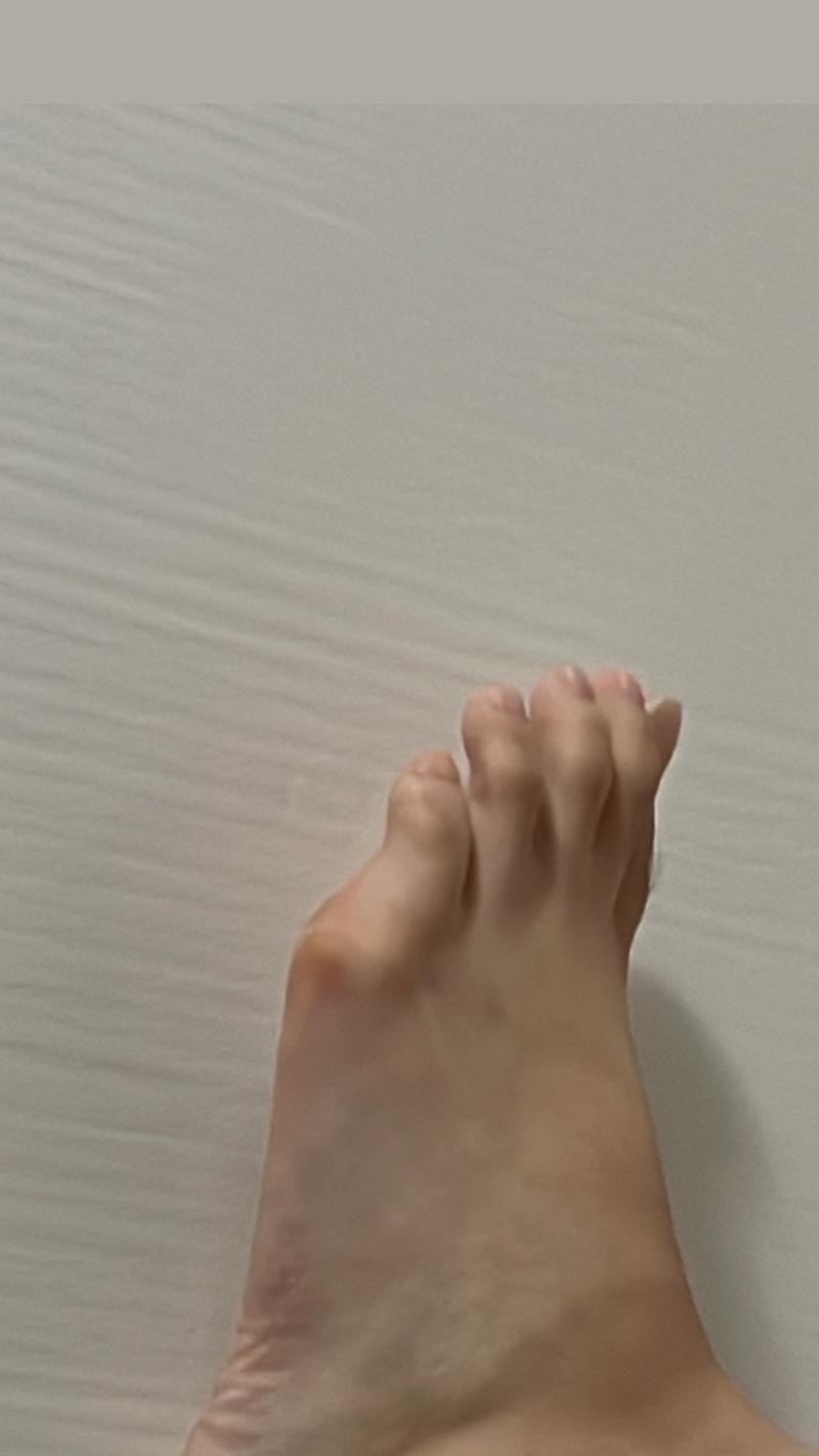 나 지금보니까 발볼이 365일 빨개