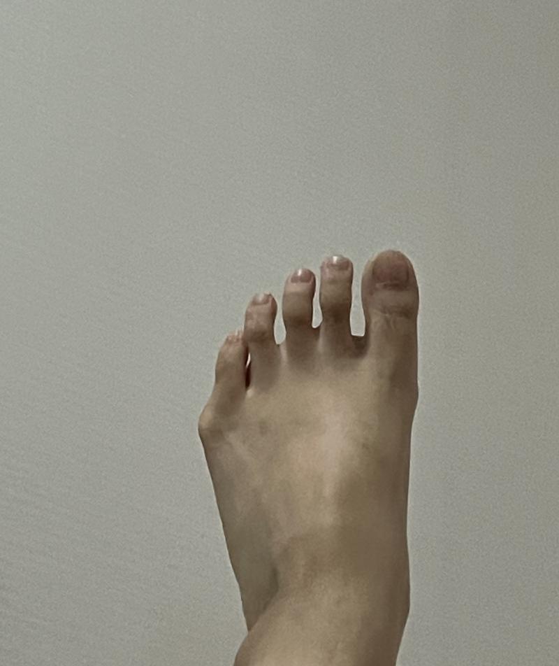 *발사진* 참고로 오션월드 갔다와서 자국남음