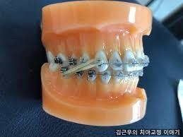 여기