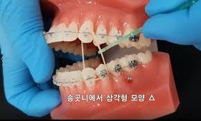 여기