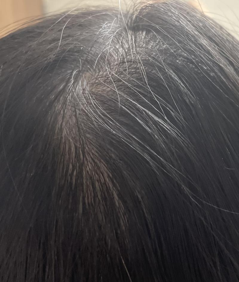 ㄹㅇ 이거 뒷통수 근접샷임….