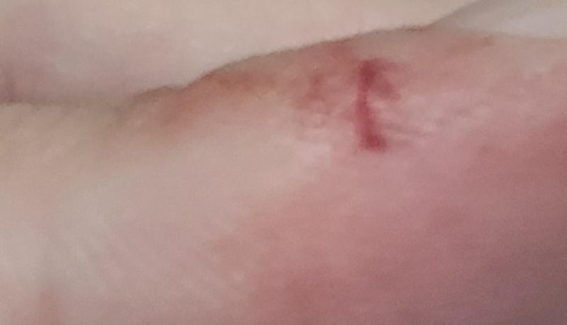 상처는 이런식으로 손가락 손목 발목에 베인것 마냥 군데군데 생기고 ㅠㅠ 몸도 너무 아프고 뭔가 저주 성공한거같긴한대... 내가 바란건 내 몸에