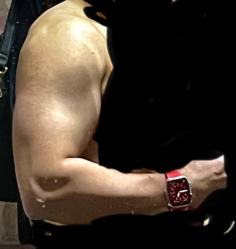 ㅇㅇ