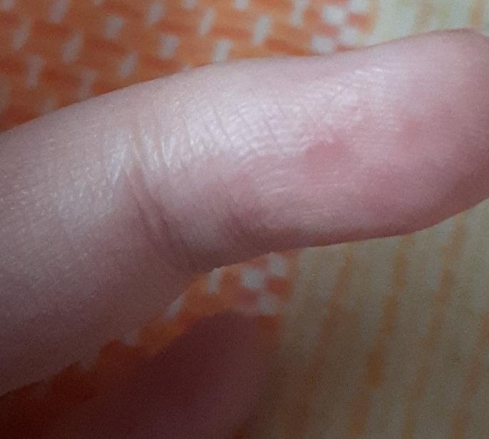 만져보면 오돌토돌해