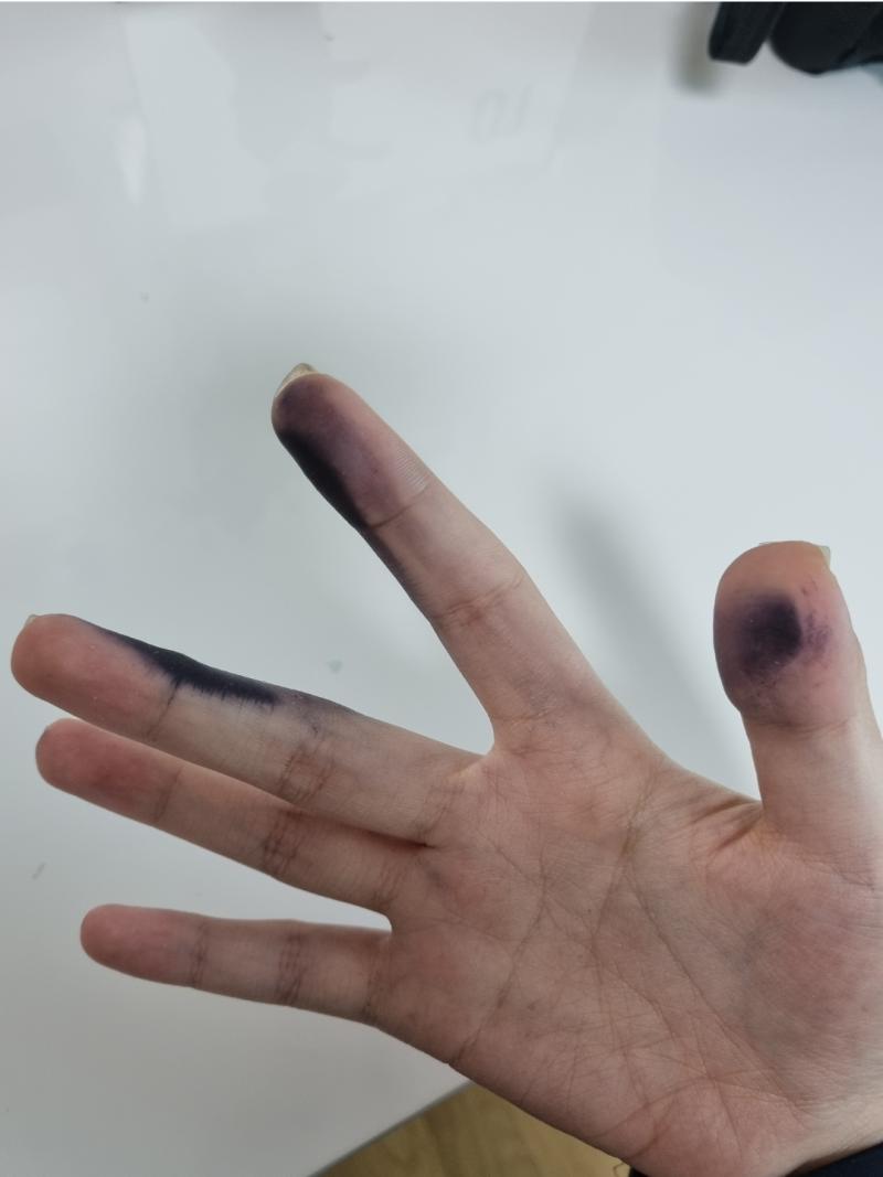 딥펜과 싸우는 나 시발 딥펜새끼 뒤질라고