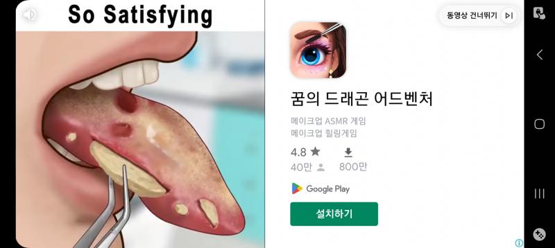(혐짤주의) 이상한게 박혀있고 그거 빼는 장면들은 대체 왜 나오는 거임? 어느 부위인지 모르겠는 것에 똥인지 뭔지 모를걸 빼는 장면도 있었어 으