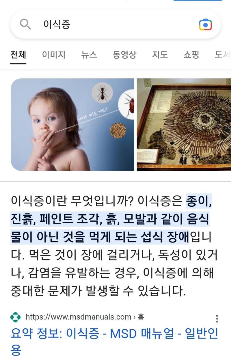 그거 이식증인데 정신병이라서 전문의학 상담 받아봐야돼