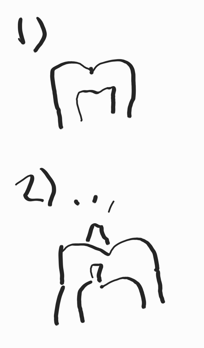 핸드폰으로 그려서 거지같은거 이해좀 다른사람들은 1처럼 나는게 정상인데 난 일부 치아가 2처럼 났다고 함 툭 튀어나온거라 하는데 놀랍게도 신경도