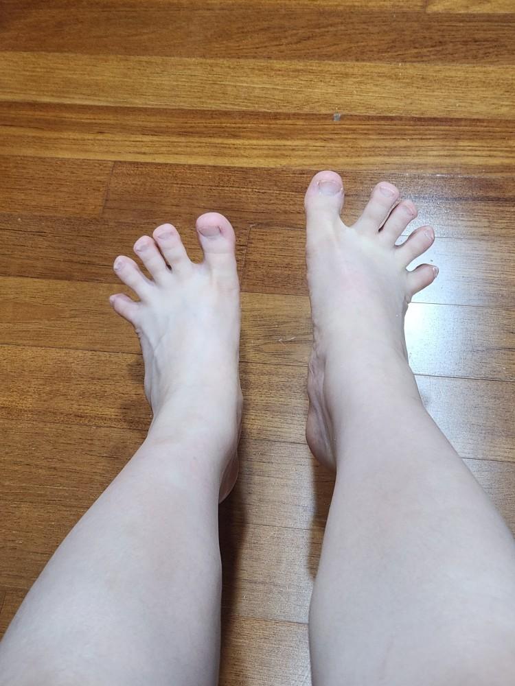 개굴.