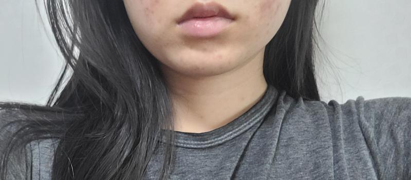 다들 턱 이래? 아님 나만 저렇게 퍼진거냐