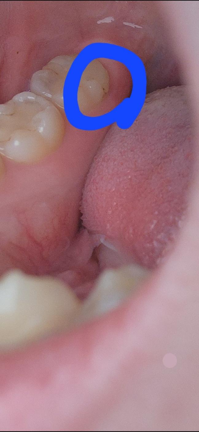파란색으로 칠한 부분ㅠㅠ