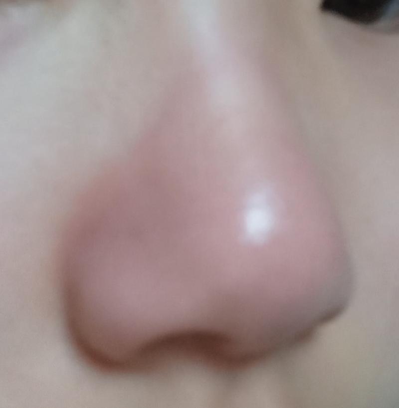 근데 이이이렇게 되버린겨 갑자기 콧망울..? 콧등?? 이 생겨버림