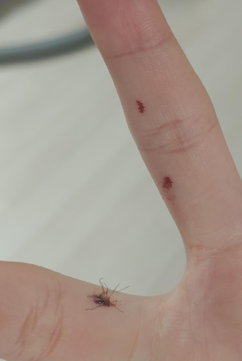짝👏