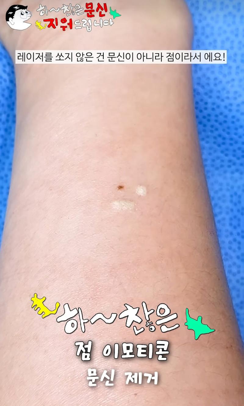 세상에서 제일 하찮은 문신