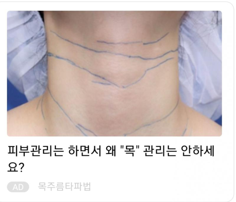 이 광고야