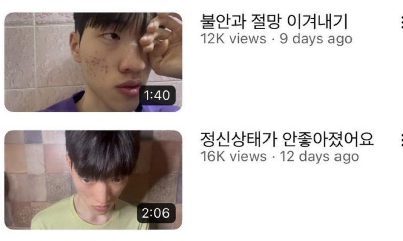 ์์ฆ ์ด๊ฑฐ ๋ฌดํ๋ฐ๋ณต์ค