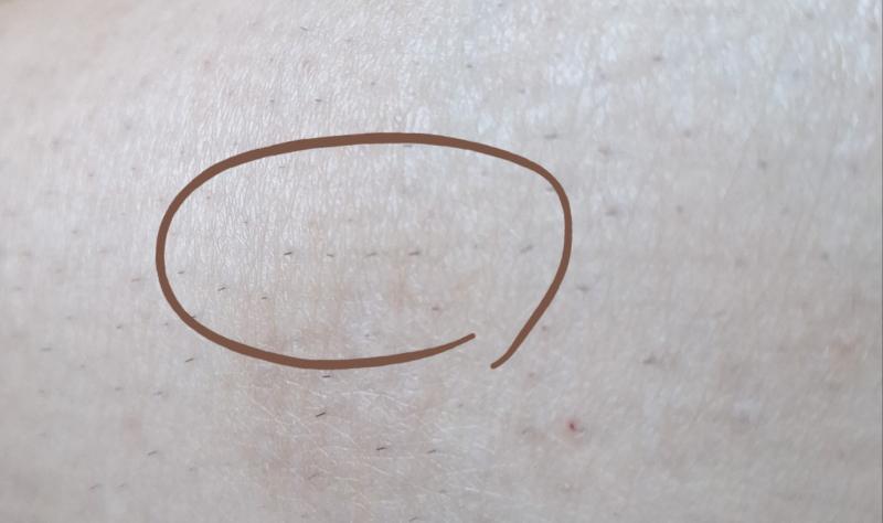얘들아 봐봐 내 다리털 쫌 신기함(혐주의) 털이 일자로 나 있음