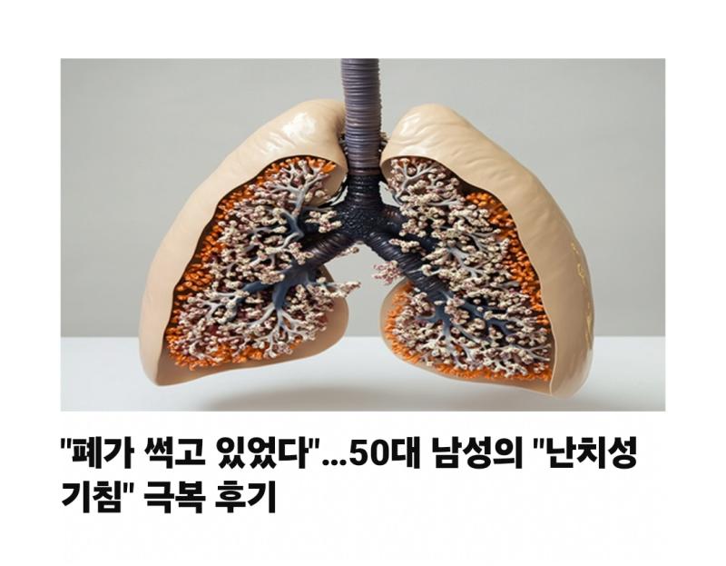 (혐주의) 보면볼수록 징그러워보여서 보기 싫음