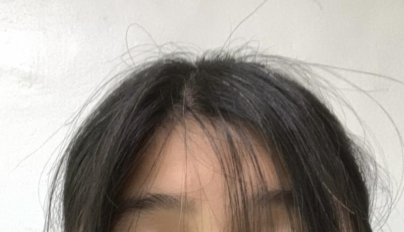 >>2 >>3 원래 1짤처럼 되어있는 머리가 2짤 처럼 남자들 쉼표머리하듯이 됨