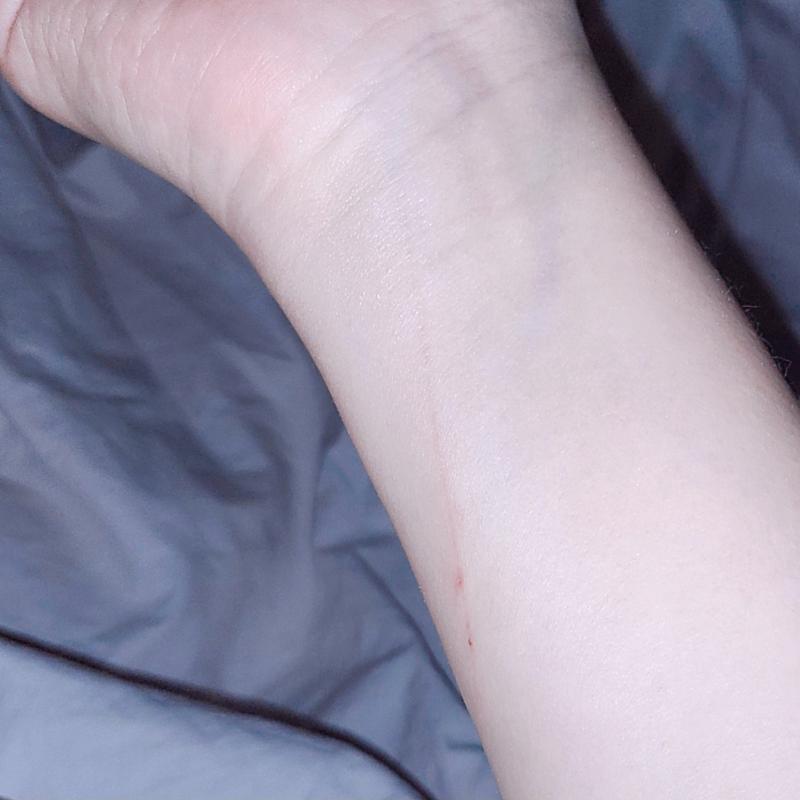 며칠전 사진이지만..ㅈㅎ 아니구 걍 요리하구 설거지 끝내고 먼가 가려워서 보니 어딘가에 긁혔었나봄 아직 옅게 상처가 있둠 그시절 생각나서 찍어봤