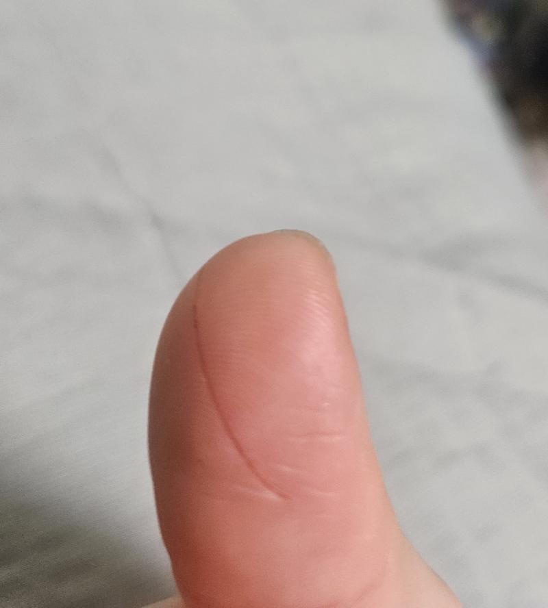 일하다가 오른쪽 엄지에 직경 2.5~3센치 정도로 크게 베임 난 내가 과일청 뚜껑에 다칠줄은 몰랐지..🥲 그래도 얕은 상처라 다행이야 내일까지만