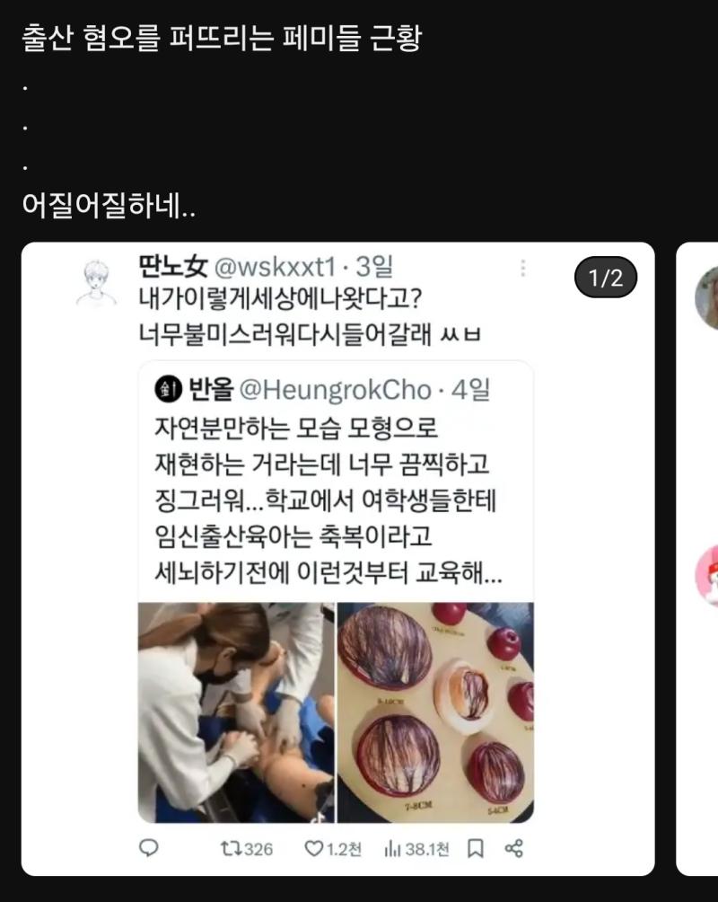 이젠 하다못해 출산 과정이 징그럽게 생겼다면서 출산혐오 하는 트페미들 아니 근데 이거 지들 낳아준 어머니 욕하는 꼴 아님??? ㅋㅋㅋㅋ 쟤넨 뭐