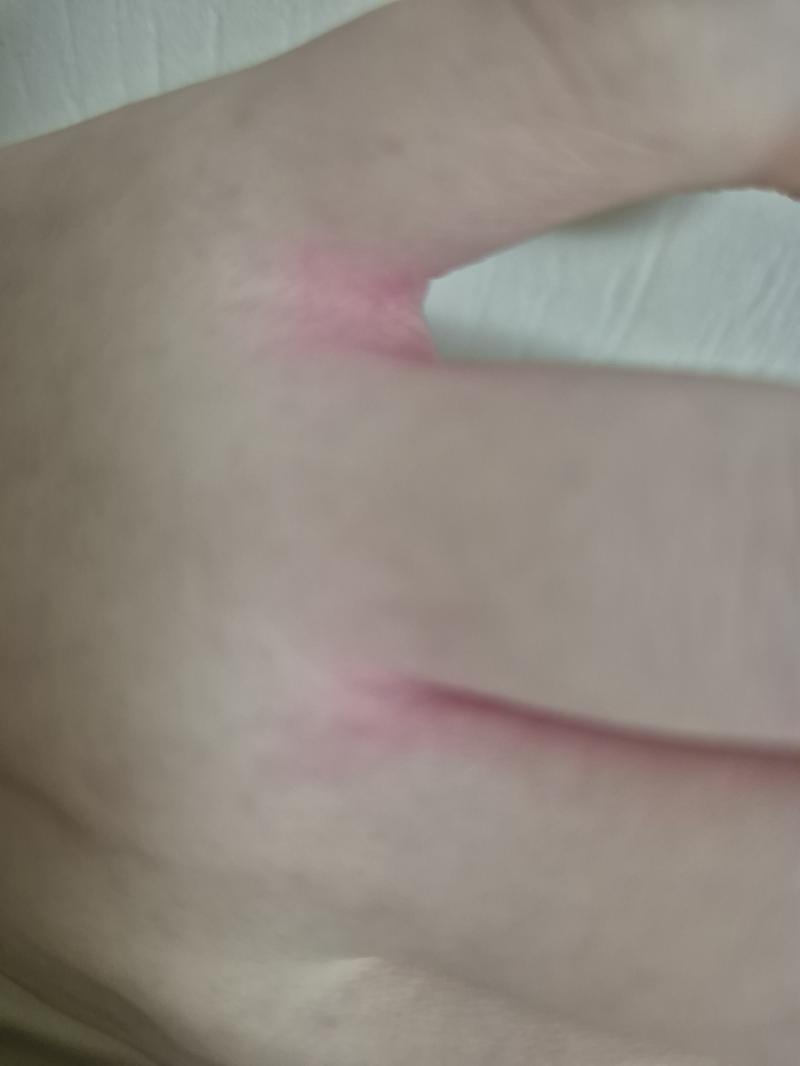 ㅎ 핑크 인간이 되....... 무릎 복숭아뼈 팔꿈치 등등이 핑크색인 인간이 되고 싶으신가요? 핑크색 잉크를 쏟으시면 가능합니다. 만요 사쿠라