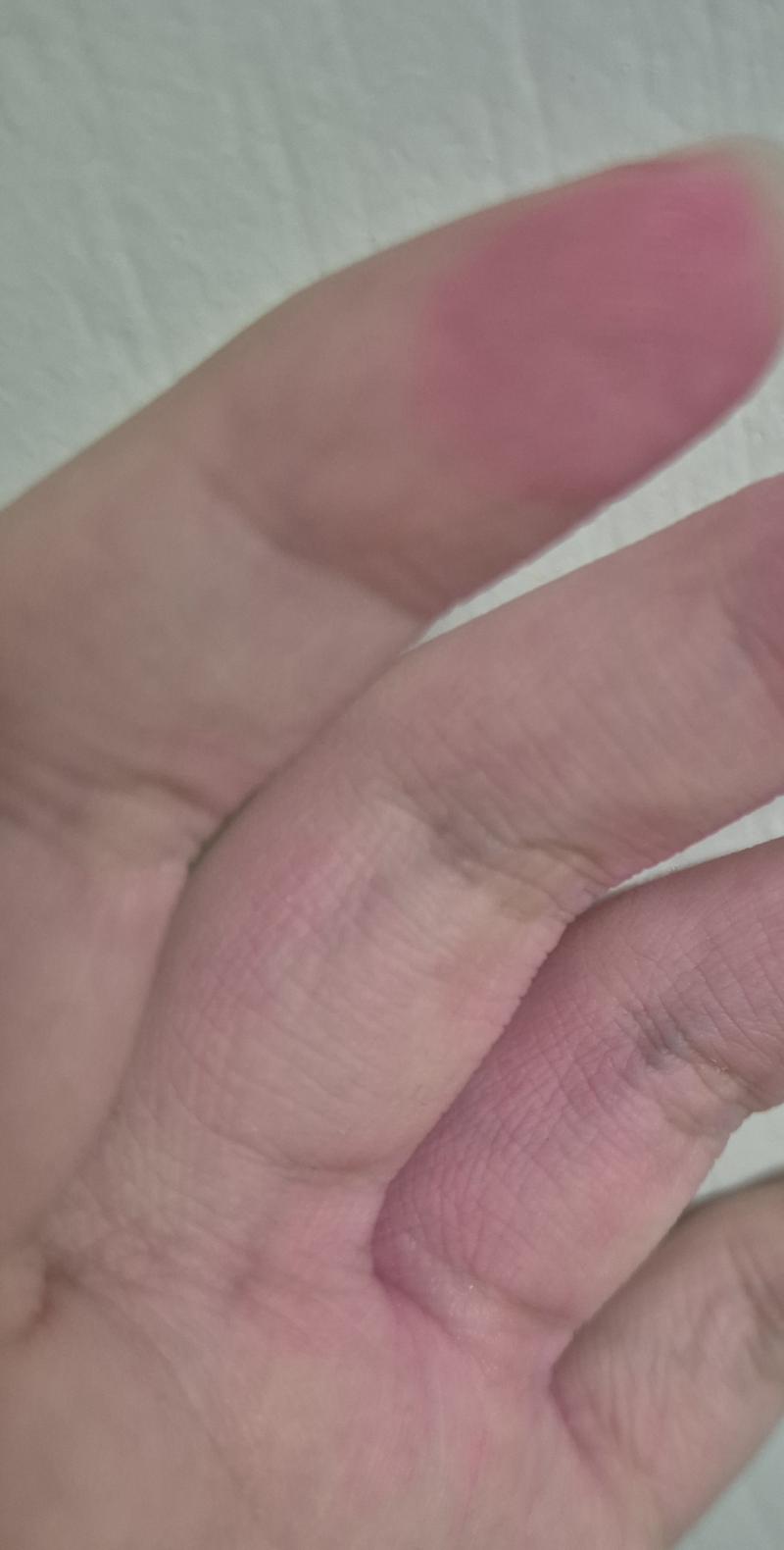 ㅎ 핑크 인간이 되....... 무릎 복숭아뼈 팔꿈치 등등이 핑크색인 인간이 되고 싶으신가요? 핑크색 잉크를 쏟으시면 가능합니다. 만요 사쿠라