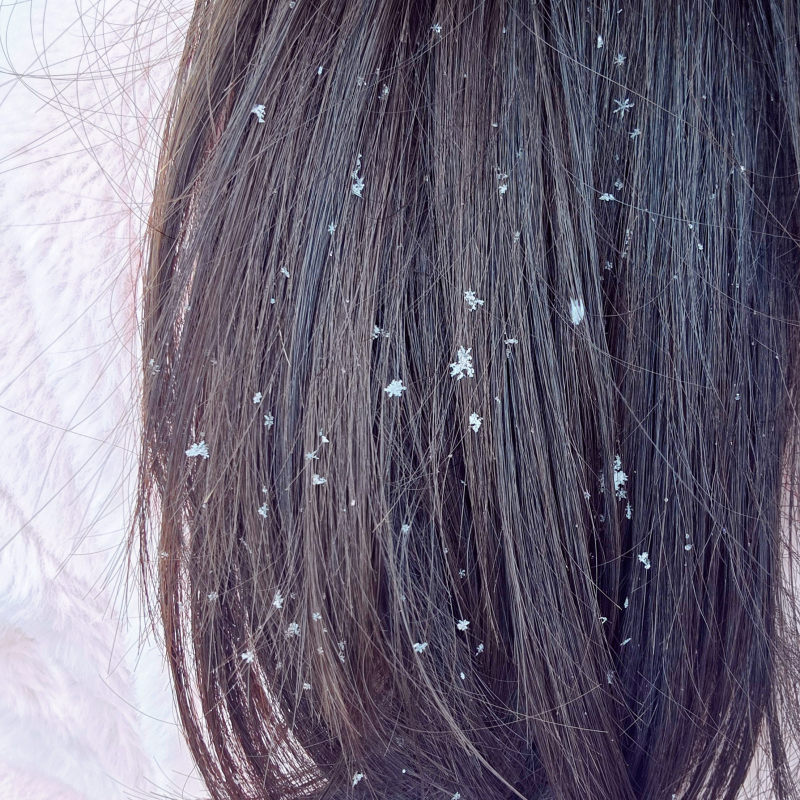 눈결정 찍어보고 싶었는데 마침 내 머리카락에 내려앉아서 찍오따❄️🩵