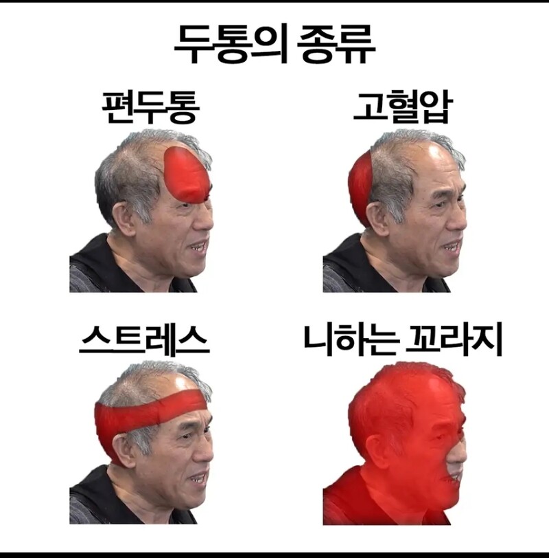 프랑스어 정일영 교수님 너무 웃기다 초상권 침해되도 좋으니 모르는 사람들 없게끔 만들어달래 ??? : 프랑스에 가서 말이 안통하면 소리를 크게 